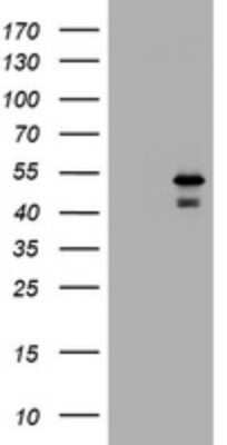 Western Blot: PARVB Antibody (OTI1B7) - Azide and BSA Free [NBP2-73248] - Analysis of HEK293T cells were transfected with the pCMV6-ENTRY control (Left lane) or pCMV6-ENTRY PARVB.