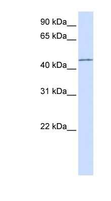 Western Blot: PARVB Antibody [NBP1-59129] - Titration: 0.2-1 ug/ml, Positive Control: Transfected 293T.