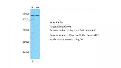 Western Blot: PARVB Antibody [NBP1-59129] - Host: Rabbit. Target: PARVB. Positive control (+): Hela (HL). Negative control (-): HepG2 (HG). Antibody concentration: 1ug/ml.