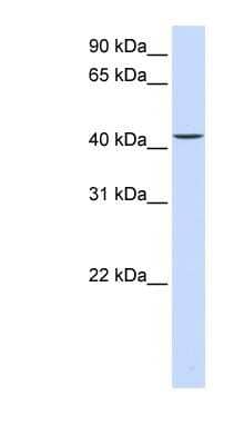 Western Blot: PARVB Antibody [NBP1-59135] - Titration: 0.2-1 ug/ml, Positive Control: Human Liver.