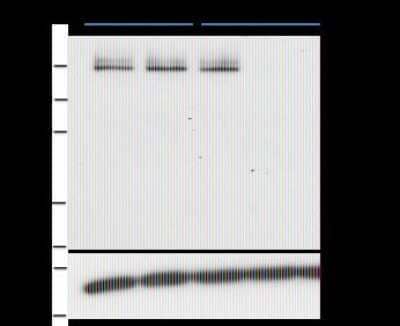 Western Blot: PASD1 Antibody (2ALCC128) [NBP2-50234] - Evaluation of PASD1 silencing with three independent PASD1 siRNAs was performed to validate the identity of the endogenous protein detected by Western Blotting in BT-20 breast cancer cells. Controls from left to right are untreated, mock siRNA, control siRNA. Experiments in other cell types have given similar results. There may be some variability in the m.wt. of PASD1, 100-150kDa.