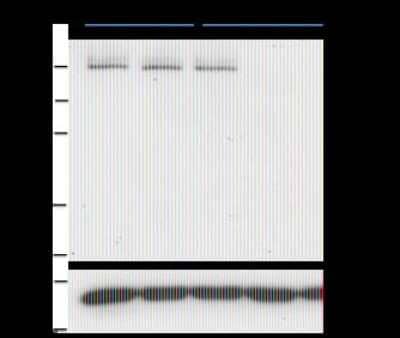 Western Blot: PASD1 Antibody (2ALCC136) [NBP2-50235] - Western Blotting PASD1 silencing with three independent PASD1 siRNAs was performed to validate the identity of the endogenous protein detected by Western Blotting in BT-20 breast cancer cells. Controls from left to right are untreated, mock siRNA, control siRNA. Experiments in other cell types have given similar results. There may be some variability in the m.wt. of PASD1, 100-150kDa.