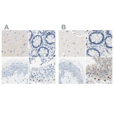 Immunohistochemistry-Paraffin PASD1 Antibody