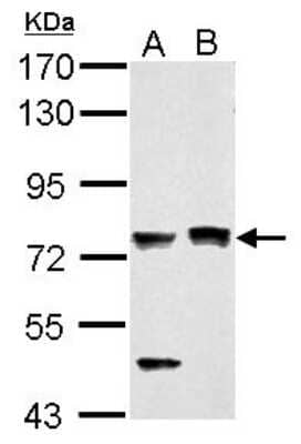Western Blot: PASD1 Antibody [NBP2-19703] - Sample (30 ug of whole cell lysate) A: PC-3 B: SK-N-SH 7. 5% SDS PAGE gel, diluted at 1:1000.