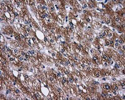 Immunohistochemistry-Paraffin: PASK Antibody (8G9) [NBP2-02242] - Staining of paraffin-embedded Human liver tissue using anti-PASK mouse monoclonal antibody.