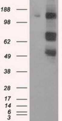 Western Blot: PASK Antibody (8G9) [NBP2-02242] - HEK293T cells were transfected with the pCMV6-ENTRY control (Left lane) or pCMV6-ENTRY PASK (Right lane) cDNA for 48 hrs and lysed. Equivalent amounts of cell lysates (5 ug per lane) were separated by SDS-PAGE and immunoblotted with anti-PASK.