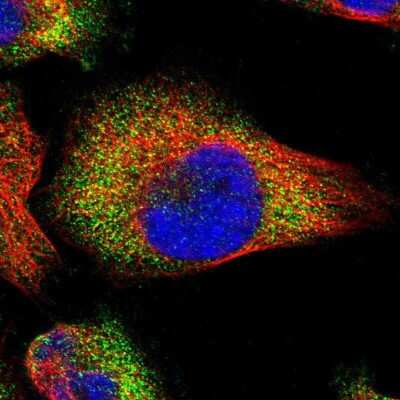 Immunocytochemistry/Immunofluorescence: PASK Antibody [NBP1-83037] - Immunofluorescent staining of human cell line U-251 MG shows localization to cytosol.