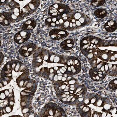 Immunohistochemistry-Paraffin: PASK Antibody [NBP1-83037] - Staining of human small intestine shows strong cytoplasmic positivity in glandular cells.