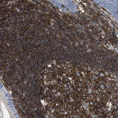 Immunohistochemistry-Paraffin: PASK Antibody [NBP1-83038] - Staining of human appendix shows strong cytoplasmic positivity in lymphoid cells.