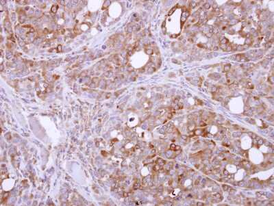 Immunohistochemistry-Paraffin: PASK Antibody [NBP2-19704] - xenograft, using PASK  antibody at 1:500 dilution. Antigen Retrieval: Citrate buffer, pH 6.0, 15 min. 