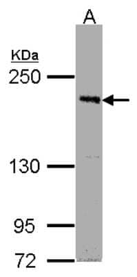 Western Blot: PASK Antibody [NBP1-32648] - Sample (30ug whole cell lysate)A:Raji 5% SDS PAGE, antibody diluted at 1:1000.