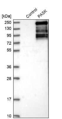 Western Blot: PASK Antibody [NBP1-83037] - Analysis in control (vector only transfected HEK293T lysate) and PASK over-expression lysate (Co-expressed with a C-terminal myc-DDK tag (3.1 kDa) in mammalian HEK293T cells).