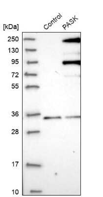 Western Blot: PASK Antibody [NBP1-83038] - Analysis in control (vector only transfected HEK293T lysate) and PASK over-expression lysate (Co-expressed with a C-terminal myc-DDK tag (3.1 kDa) in mammalian HEK293T cells).