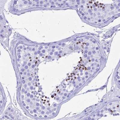 Immunohistochemistry-Paraffin: PATE4 Antibody [NBP1-93774] Staining of human testis shows strong cytoplasmic positivity in cells in seminiferus ducts.