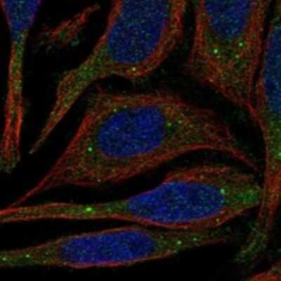 Immunocytochemistry/Immunofluorescence: PATL1 Antibody [NBP3-17411] - Staining of human cell line SiHa shows localization to cytosol & cytoplasmic bodies.