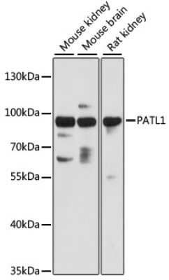 Western Blot: PATL1 Antibody [NBP2-93589] - Analysis of extracts of various cell lines, using PATL1 at 1:3000 dilution.Secondary antibody: HRP Goat Anti-Rabbit IgG (H+L) at 1:10000 dilution.Lysates/proteins: 25ug per lane.Blocking buffer: 3% nonfat dry milk in TBST.Detection: ECL Basic Kit .Exposure time: 30s.