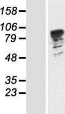 Western Blot: PATL1 Overexpression Lysate (Adult Normal) [NBP2-05320] Left-Empty vector transfected control cell lysate (HEK293 cell lysate); Right -Over-expression Lysate for PATL1.