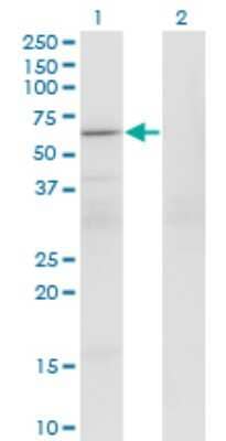 Western Blot: PATZ Antibody (1B2) [H00023598-M01] - Analysis of PATZ1 expression in transfected 293T cell line by PATZ1 monoclonal antibody (M01), clone 1B2.Lane 1: PATZ1 transfected lysate (Predicted MW: 57.6 KDa).Lane 2: Non-transfected lysate.