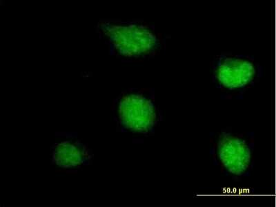 Immunocytochemistry/Immunofluorescence: PATZ Antibody [H00023598-B01P] - Analysis of purified antibody to ZNF278 on HeLa cell. (antibody concentration 10 ug/ml)