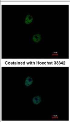 Immunocytochemistry/ Immunofluorescence PATZ Antibody