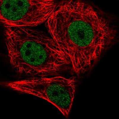 Immunocytochemistry/Immunofluorescence: PATZ Antibody [NBP2-48884] - Immunofluorescent staining of human cell line MCF7 shows localization to nucleoplasm. Antibody staining is shown in green.