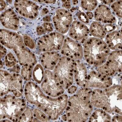 Immunohistochemistry: PATZ Antibody [NBP2-48884] - Staining of human kidney shows strong nuclear and cytoplasmic positivity in cells in tubules.