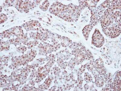 Immunohistochemistry-Paraffin PATZ Antibody