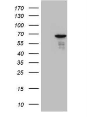 Western Blot: PATZ Antibody (OTI8D6) - Azide and BSA Free [NBP2-73256] - HEK293T cells were transfected with the pCMV6-ENTRY control (Left lane) or pCMV6-ENTRY PATZ1 ( Right lane) cDNA for 48 hrs and lysed. Equivalent amounts of cell lysates (5 ug per lane) were separated by SDS-PAGE and immunoblotted with antiPATZ1.(1:2000)