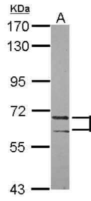 Western Blot PATZ Antibody