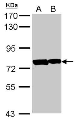 Western Blot: PATZ Antibody [NBP2-19709] - Sample (30 ug of whole cell lysate) A: A549 B: Hela 7. 5% SDS PAGE gel, diluted at 1:1000.