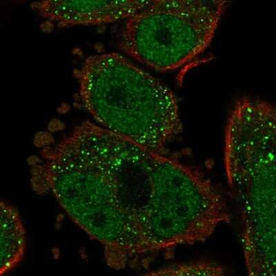 Immunocytochemistry/Immunofluorescence: PAUF/ZG16B Antibody [NBP2-49089] - Immunofluorescent staining of human cell line PC-3 shows localization to nucleoplasm & vesicles.