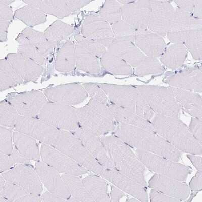 Immunohistochemistry-Paraffin: PAUF/ZG16B Antibody [NBP1-81699] - Staining of human skeletal muscle shows no positivity in myocytes as expected.