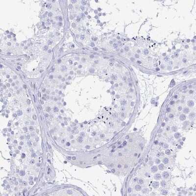 Immunohistochemistry-Paraffin: PAUF/ZG16B Antibody [NBP1-81699] - Staining of human testis shows no positivity in cells in seminiferous ducts as expected.