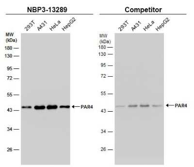 Western Blot: PAWR / PAR4 Antibody [NBP3-13289] - Various whole cell extracts (30 ug) were separated by 10% SDS-PAGE, and the membranes were blotted with PAWR / PAR4 antibody (NBP3-13289) diluted at 1:1000 and competitor's antibody diluted at 1:1000. The HRP-conjugated anti-rabbit IgG antibody (NBP2-19301) was used to detect the primary antibody, and the signal was developed with Trident ECL plus-Enhanced.