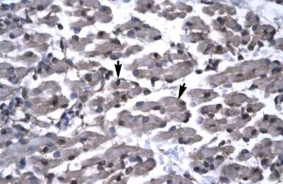 Immunohistochemistry: PAWR Antibody [NBP3-10923] - Immunohistochemical analysis of human muscle.