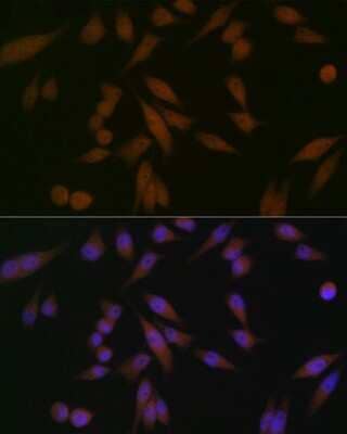 Immunocytochemistry/Immunofluorescence: PAWR / PAR4 Antibody (10Q2G9) [NBP3-16523] - Immunofluorescence analysis of HeLa cells using PAWR / PAR4 Rabbit mAb (NBP3-16523) at dilution of 1:100 (40x lens). Blue: DAPI for nuclear staining.