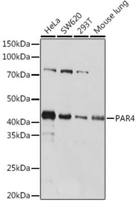 Western Blot PAWR / PAR4 Antibody (10Q2G9)