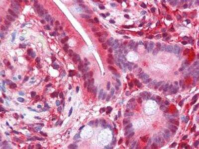 Immunohistochemistry-Paraffin: PAWR / PAR4 Antibody (3G9H7) [NBP1-28892] - Analysis of human Small Intestine tissues using PAR4 mouse mAb.