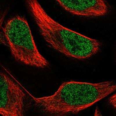 Immunocytochemistry/Immunofluorescence: PAX8 Antibody [NBP1-89436] - Staining of human cell line U-2 OS shows localization to nucleoplasm. Antibody staining is shown in green.