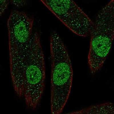 Immunocytochemistry/Immunofluorescence: PAX8 Antibody [NBP2-56890] - Staining of human cell line RPTEC TERT1 shows localization to nucleoplasm.