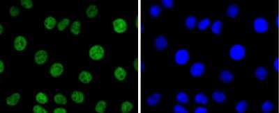 Immunocytochemistry/Immunofluorescence: PAX8 Antibody (JJ08-88) [NBP2-67876] - Staining PAX8 in SKOV-3 cells (green). The nuclear counter stain is DAPI (blue). Cells were fixed in paraformaldehyde, permeabilised with 0.25% Triton X100/PBS.