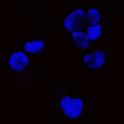 Immunocytochemistry: PAX8 Antibody (JJ08-88) [NBP2-67876] - Usage of PAX8 antibody in HL60 cells (negative control)