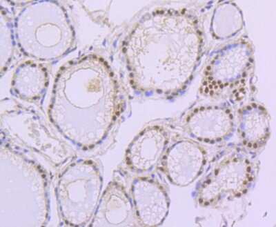 Immunohistochemistry-Paraffin: PAX8 Antibody (JJ08-88) [NBP2-67876] - Analysis of paraffin-embedded human thyroid tissue using anti-PAX8 antibody. Counter stained with hematoxylin.