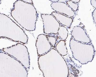 Immunohistochemistry-Paraffin: PAX8 Antibody (JJ08-88) [NBP2-67876] - Immunohistochemical analysis of paraffin-embedded human thyroid tissue using anti-PAX8 antibody. The section was pre-treated using heat mediated antigen retrieval with sodium citrate buffer (pH 6.0) for 20 minutes. The tissues were blocked in 5% BSA for 30 minutes at room temperature, washed with ddH2O and PBS, and then probed with the primary antibody (1/200) for 30 minutes at room temperature. The detection was performed using an HRP conjugated compact polymer system. DAB was used as the chromogen. Tissues were counterstained with hematoxylin and mounted with DPX.