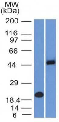 Western Blot: PAX8 Antibody (PAX8/1491 + PAX8/1492) - Azide and BSA Free [NBP3-08274] - Western Blot Analysis (A) Recombinant Protein (B) Raji cell lysate using PAX8Monoclonal Antibody (PAX8/1491 + PAX8/1492).