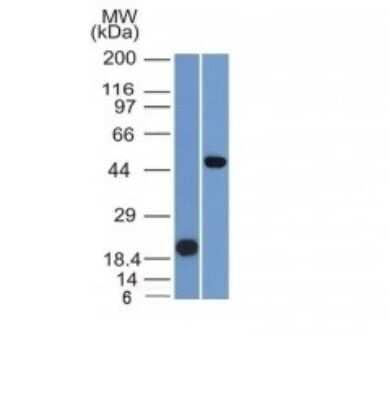 Western Blot: PAX8 Antibody (PAX8/1491) - Azide and BSA Free [NBP2-54486] - (A) Recombinant Protein (B) Raji Cell Lysate Using PAX8 Monoclonal Antibody (PAX8/1491).