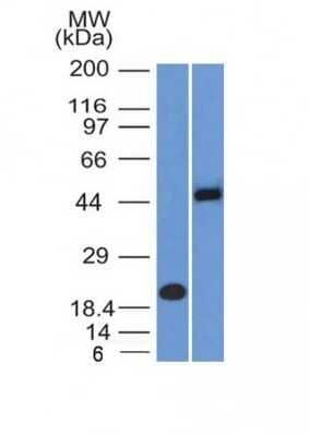 Western Blot: PAX8 Antibody (PAX8/1492) - Azide and BSA Free [NBP2-54539] - Analysis (A) Recombinant Protein (B) Raji Cell Lysate Using PAX8 Monoclonal Antibody (PAX8/1492).