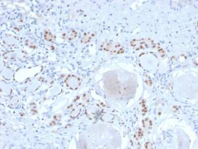 Immunohistochemistry-Paraffin: PAX8 Antibody (PAX8/2774R) - Azide and BSA Free [NBP3-08275] - Formalin-fixed, paraffin-embedded human Kidney stained with PAX8 Recombinant Rabbit Monoclonal Antibody (PAX8/2774R).