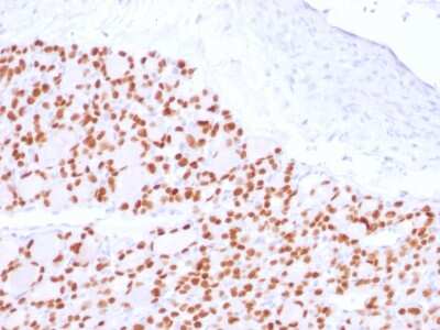 Immunohistochemistry-Paraffin: PAX8 Antibody (PAX8/2774R) - Azide and BSA Free [NBP3-08275] - Formalin-fixed, paraffin-embedded human Thyroid stained with PAX8 Recombinant Rabbit Monoclonal Antibody (PAX8/2774R).