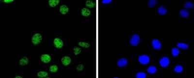 Immunocytochemistry/Immunofluorescence: PAX8 Antibody (SD0832) [NBP2-67793] - Staining PAX8 in SKOV-3 cells (green). The nuclear counter stain is DAPI (blue). Cells were fixed in paraformaldehyde, permeabilised with 0.25% Triton X100/PBS.